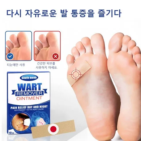 가성비 끝판왕 티눈약 베스트8